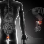 La estimulación prostática estimulación de la próstata